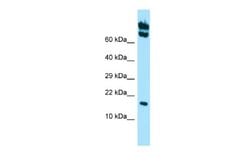 HspB11 Rabbit anti-Human, Polyclonal, Novus Biologicals 0.1ml; Unconjugated:Antibodies,